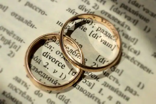Image of rings removed before divorce mediation Dronfield
